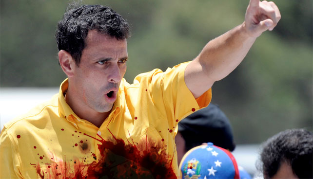 Roban órganos vitales de Capriles antes de llegar a evento en Aragua