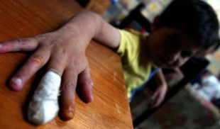 Niño que se vuela dedo con fosforito feliz porque ahora es ejemplo para futuras generaciones
