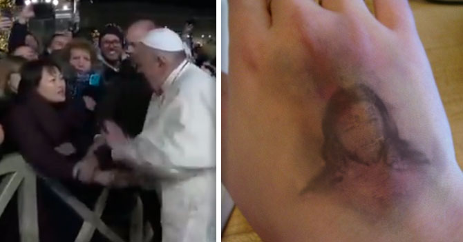 Jesucristo aparece en moretón de mano que golpeó el Papa