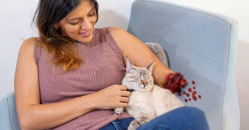 Chama asegura que su gato le amputó el brazo porque la ama