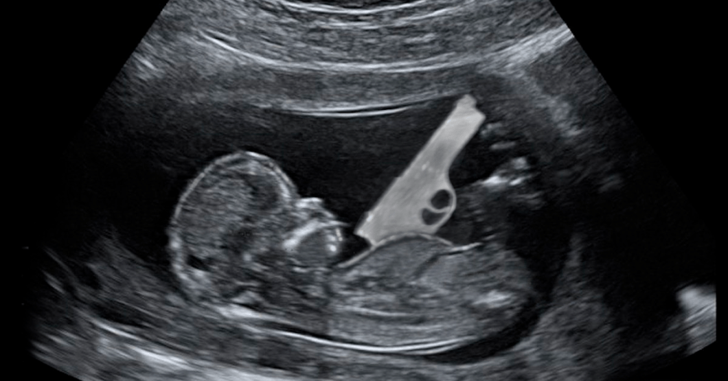 HERMOSO: Feto caraqueño empieza a desarrollar pistola en el vientre