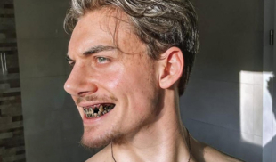 Chamo hace Looksmaxxing mascando chimó 6 veces al día para definir la mandíbula