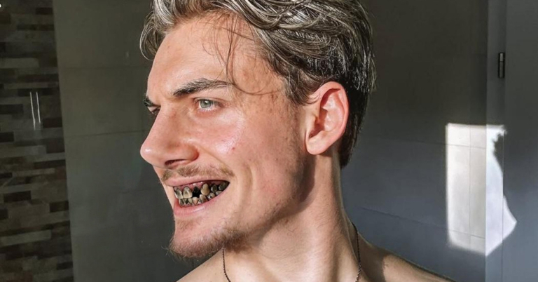 Chamo hace Looksmaxxing mascando chimó 6 veces al día para definir la mandíbula